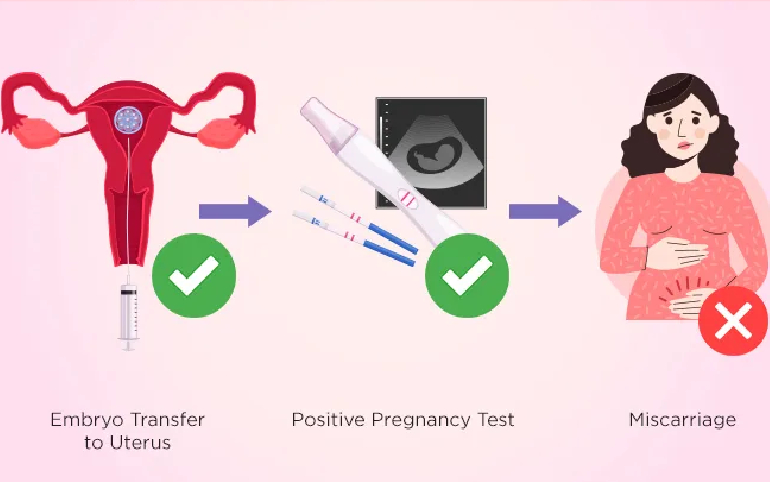 Recurrent pregnancy loss specialist Mumbai